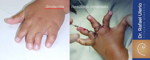 1e Reconstructiva 